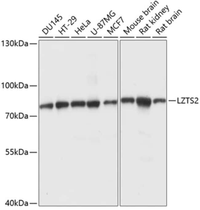 100UL LZTS2 ANTIBODY 100 ul
