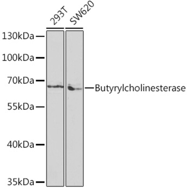 100UL BUTYRYLCHOLINESTERASE ANTIBODY 100