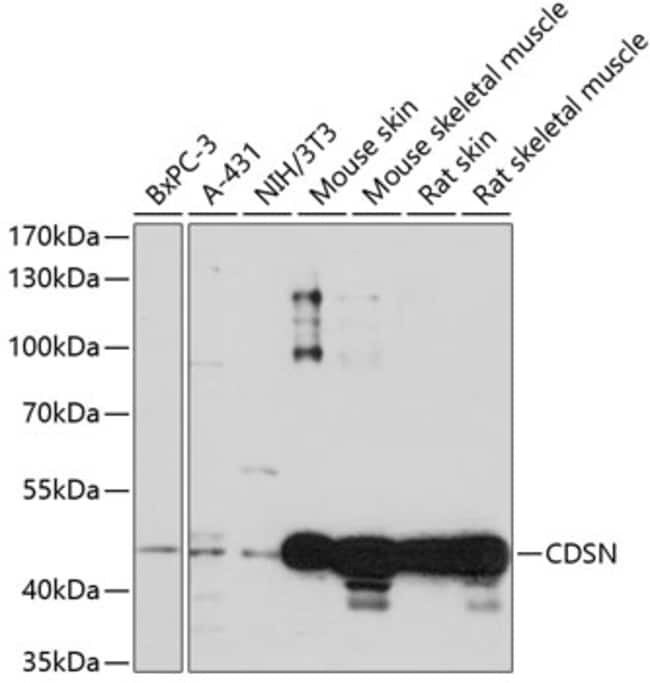 100UL CDSN ANTIBODY 100 ul