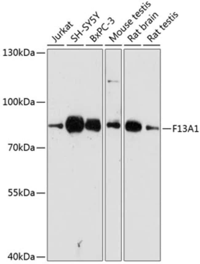 100UL FACTOR XIII A ANTIBODY 100 ul