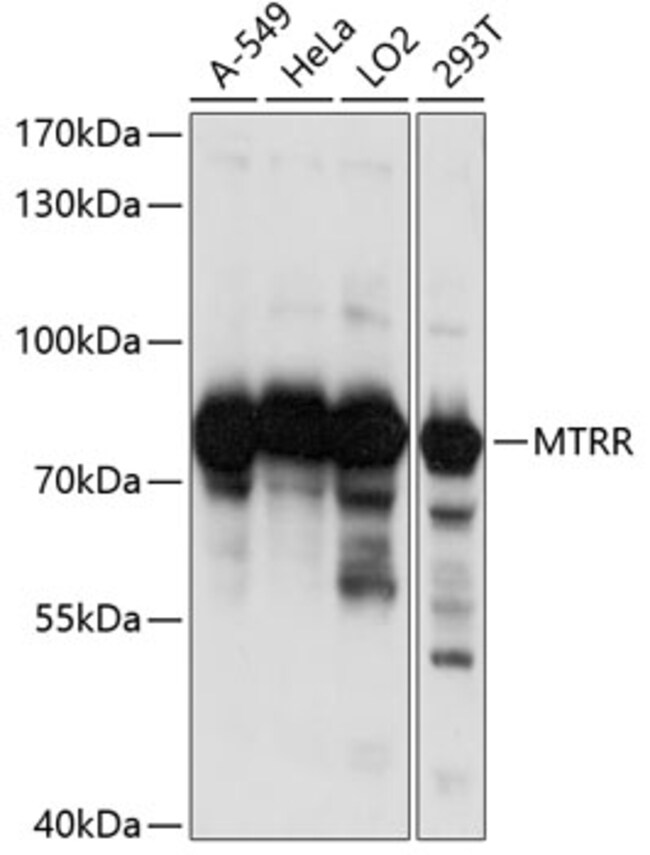 100UL MTRR ANTIBODY 100 ul
