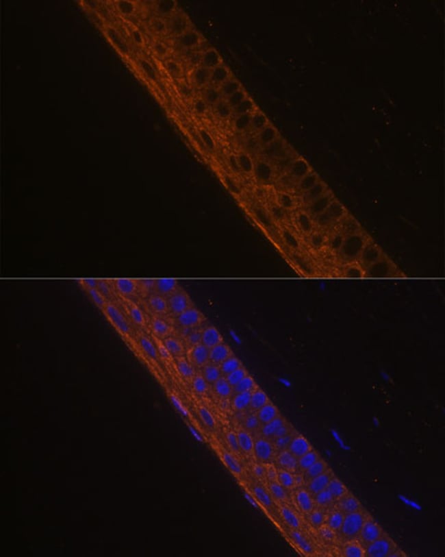 100UL MYH13 ANTIBODY 100 ul