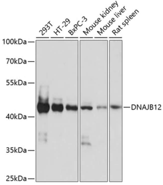 100UL DNAJB12 ANTIBODY 100 ul