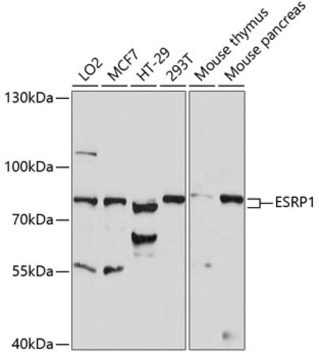 100UL ESRP1 ANTIBODY 100 ul