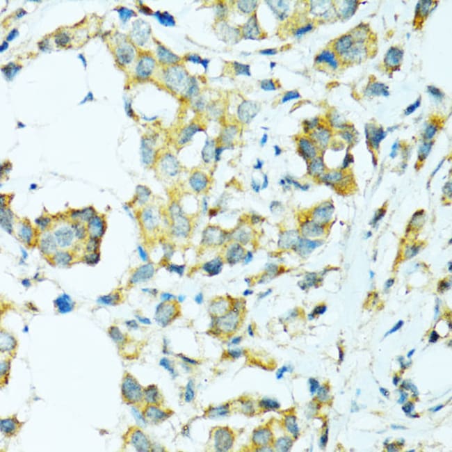 100UL CYP2B6 ANTIBODY 100 ul