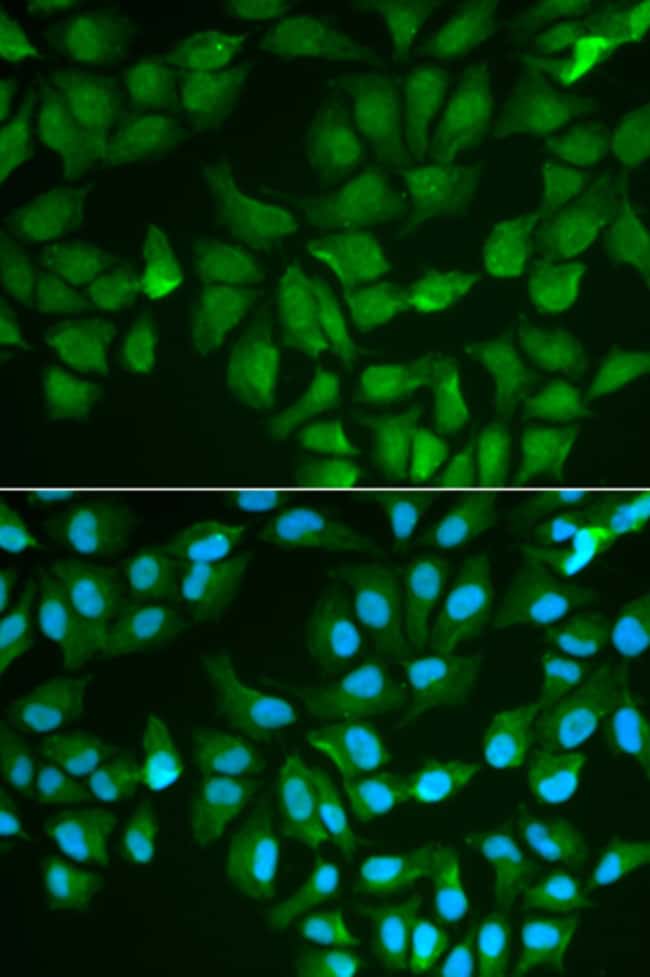 100UL GALECTIN 3 ANTIBODY 100 ul