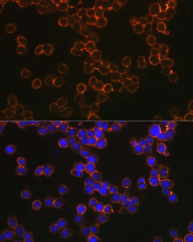 100UL DC-SIGN ANTIBODY 100 ul