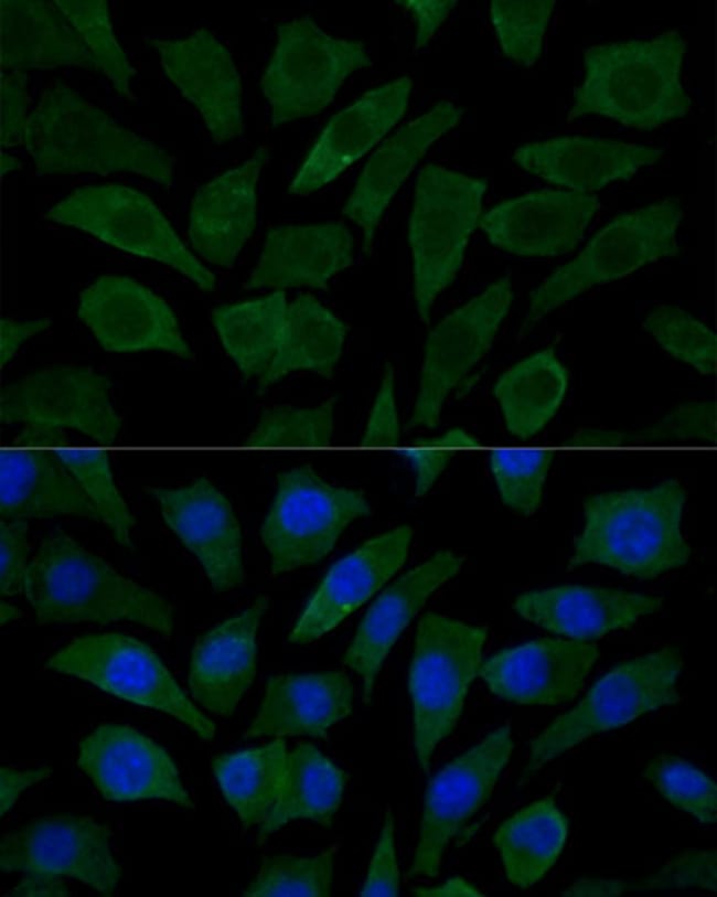 100UL COX15 ANTIBODY 100 ul