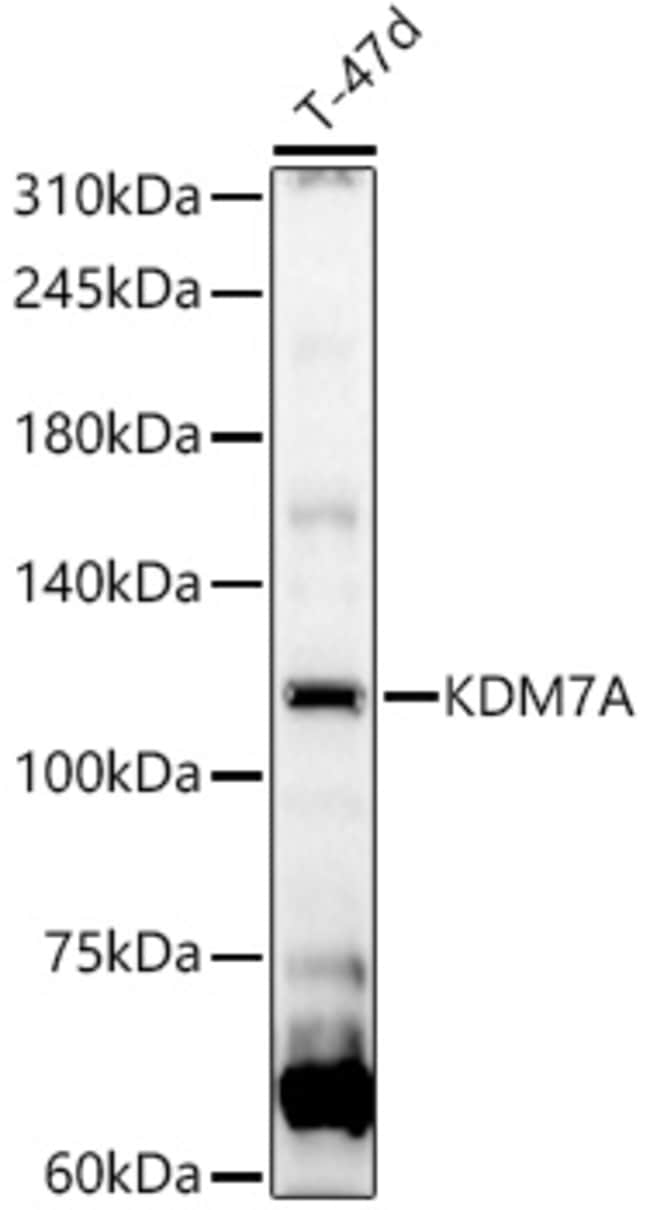 100UL JHDM1D ANTIBODY 100 ul