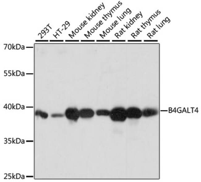 100UL B4GALT4 ANTIBODY 100 ul