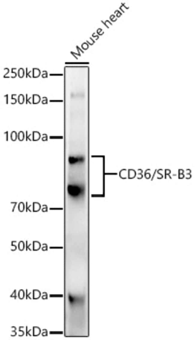 100UL CD36 ANTIBODY 100 ul