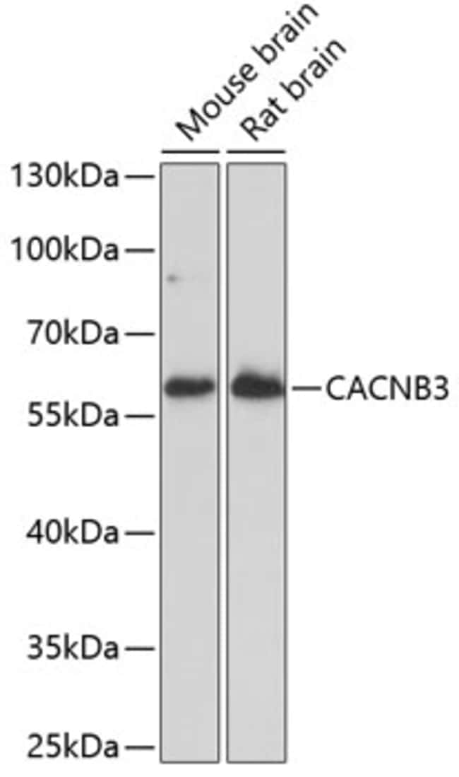 100UL CACNB3 ANTIBODY 100 ul