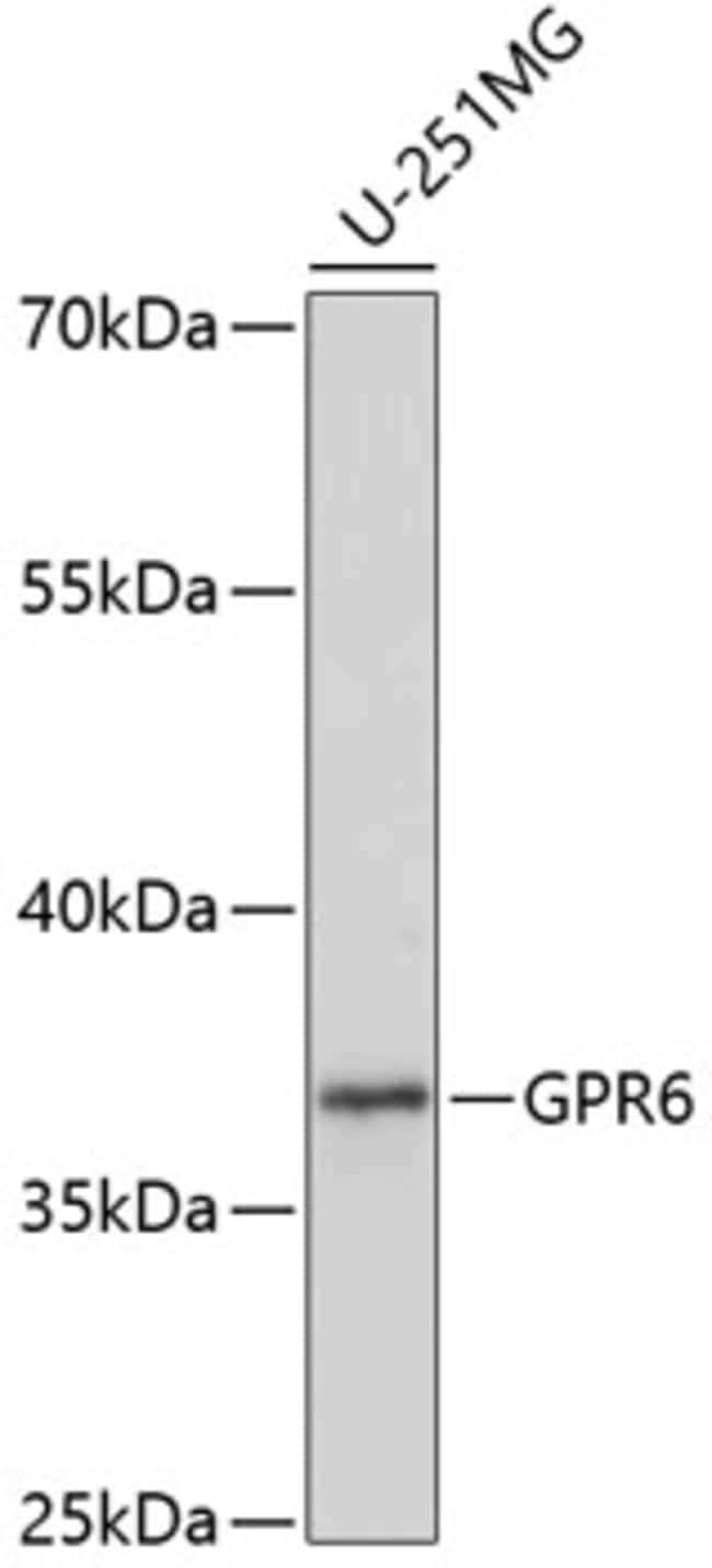 100UL GPR6 ANTIBODY 100 ul