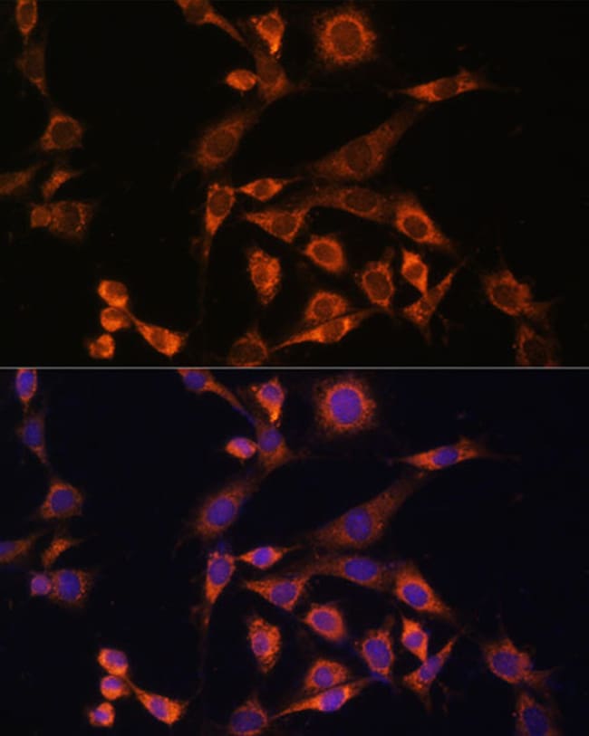 100UL MEK2 ANTIBODY 100 ul