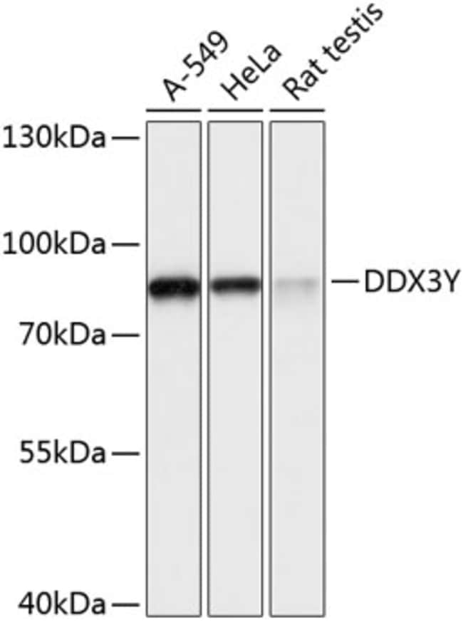 100UL DDX3Y ANTIBODY 100 ul