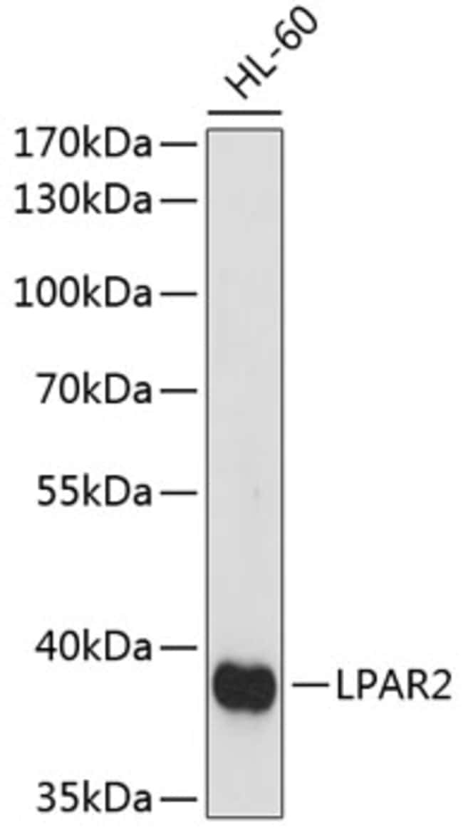 100UL EDG4 ANTIBODY 100 ul