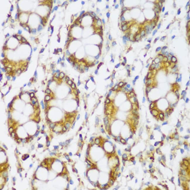 100UL ERLIN1 ANTIBODY 100 ul