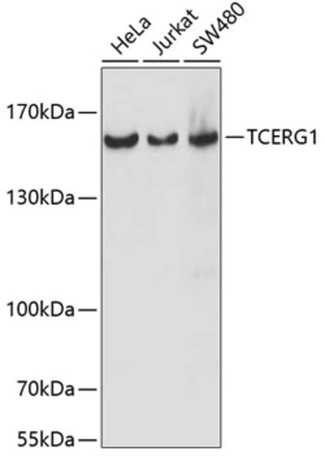 100UL CA150 ANTIBODY 100 ul