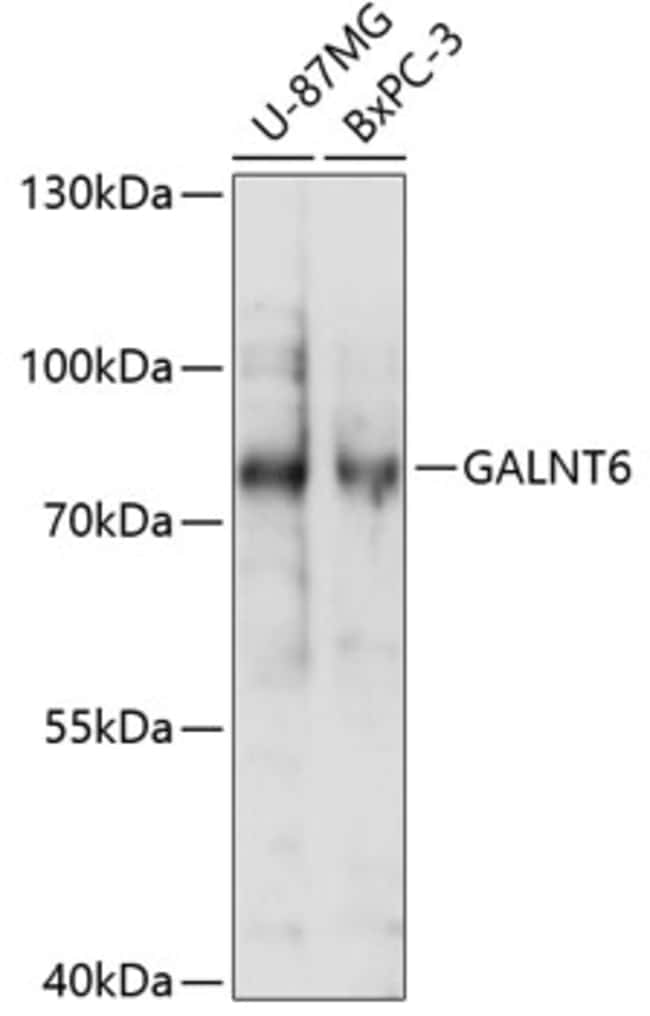 100UL GALNT6 ANTIBODY 100 ul