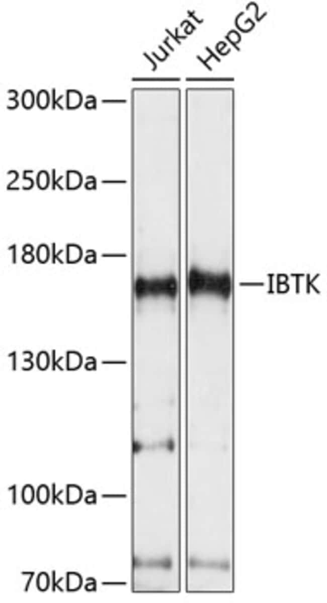 100UL IBTK ANTIBODY 100 ul