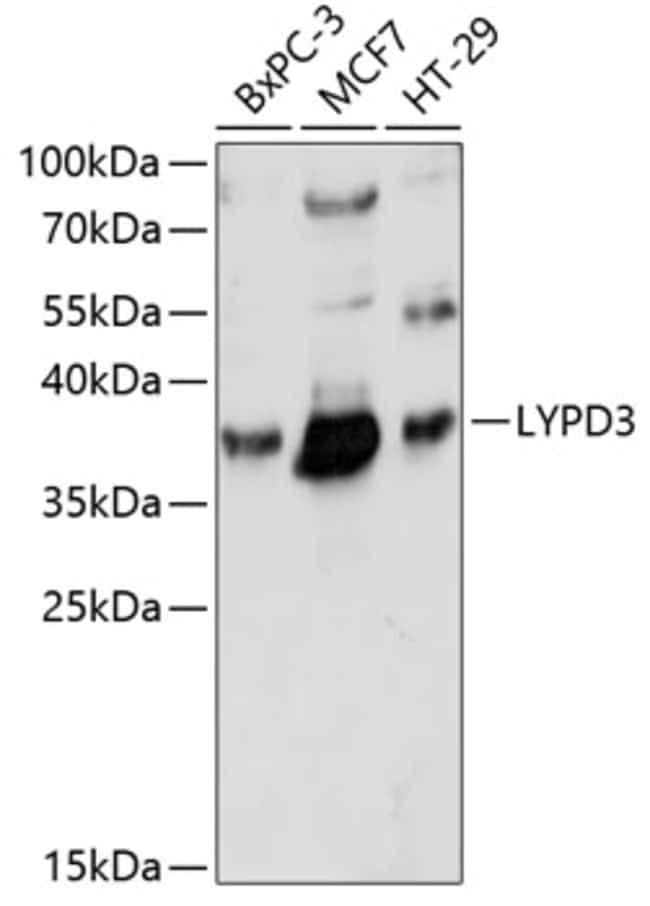 100UL LYPD3 ANTIBODY 100 ul