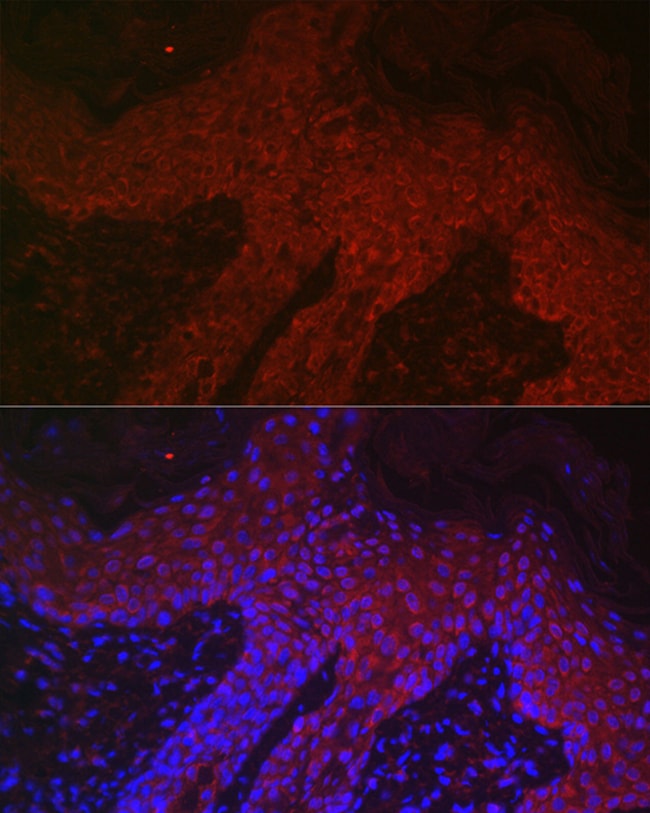 100UL DKK2 ANTIBODY 100 ul