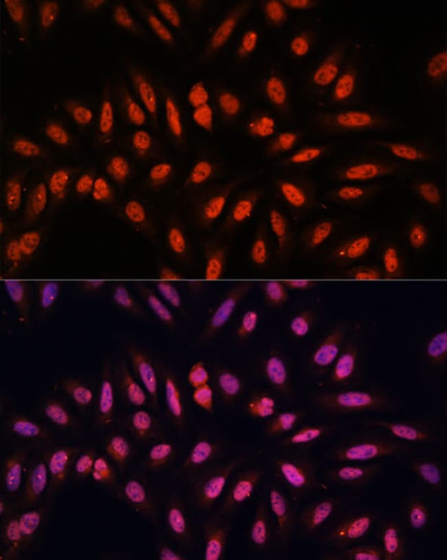 100UL KLHL8 ANTIBODY 100 ul