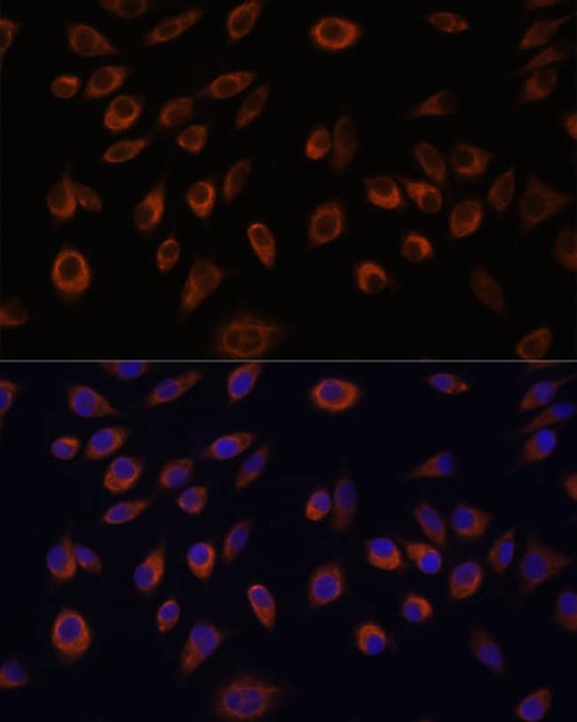 100UL C1ORF57 ANTIBODY 100 ul