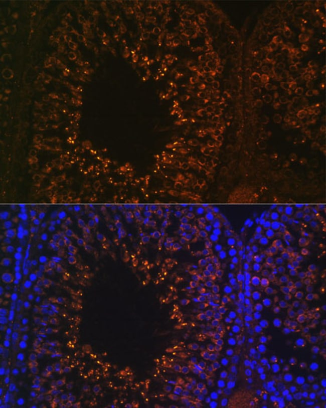 100UL LDHAL6B ANTIBODY 100 ul