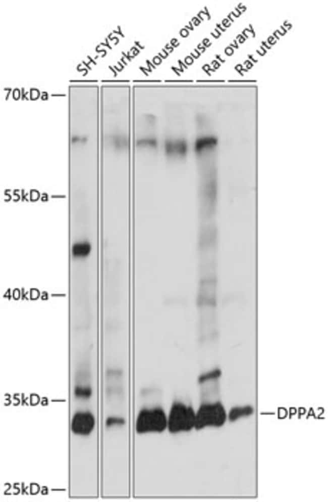100UL DPPA2 ANTIBODY 100 ul