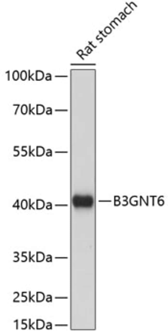 100UL B3GNT6 ANTIBODY 100 ul