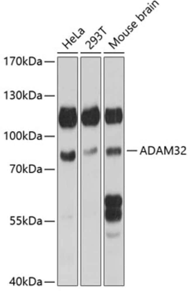 100UL ADAM32 ANTIBODY 100 ul