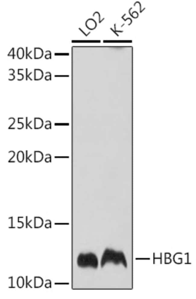 100UL HEMOGLOBIN GAMMA A ANTIBODY 100 ul