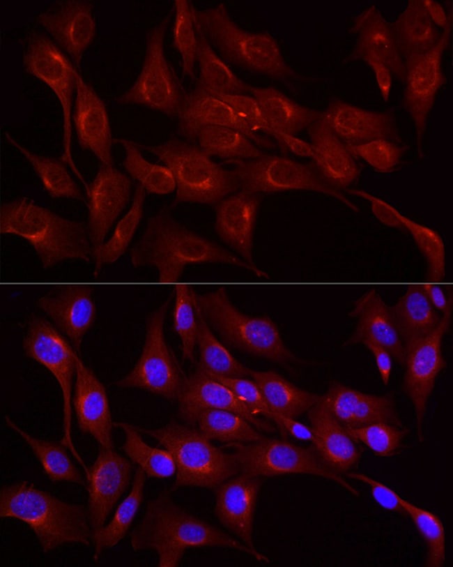 100UL LDLR ANTIBODY 100 ul