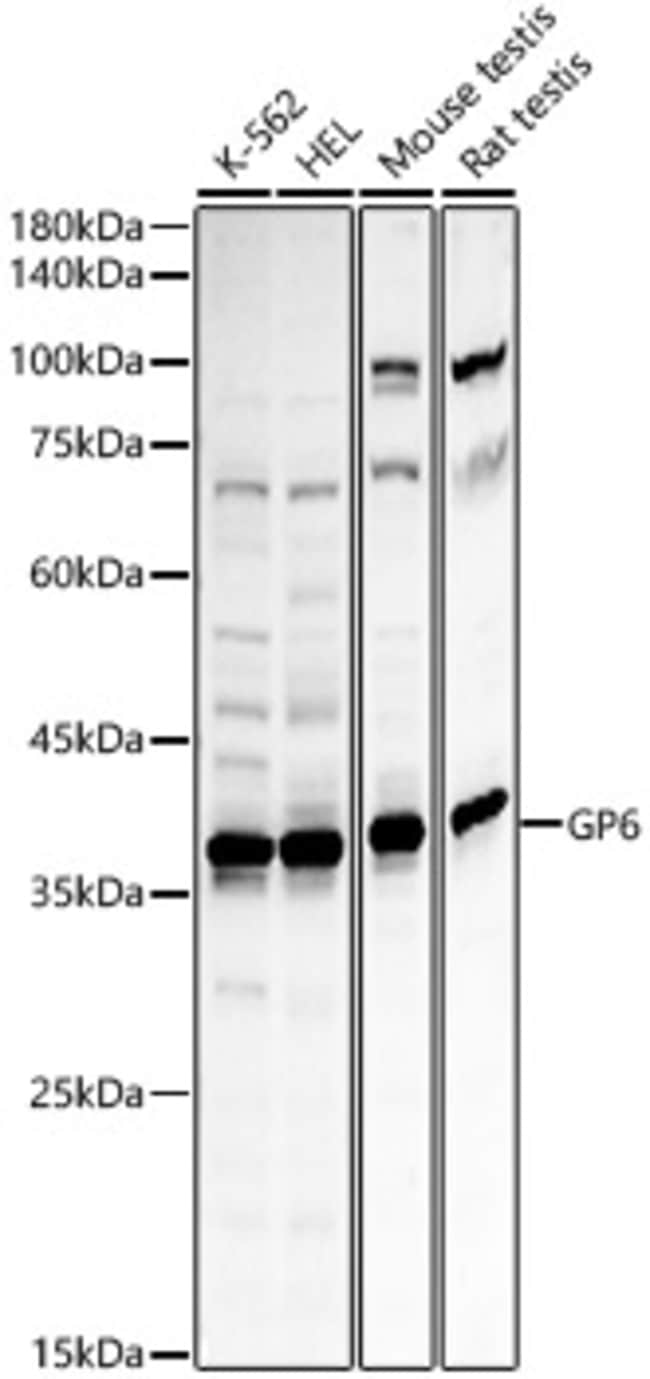 100UL GP6 ANTIBODY 100 ul
