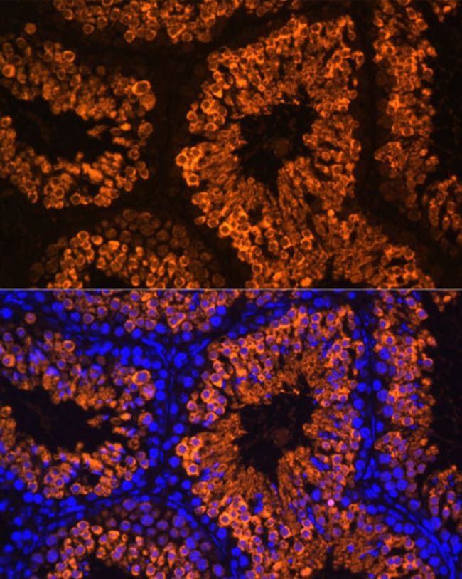 100UL LDHC ANTIBODY 100 ul