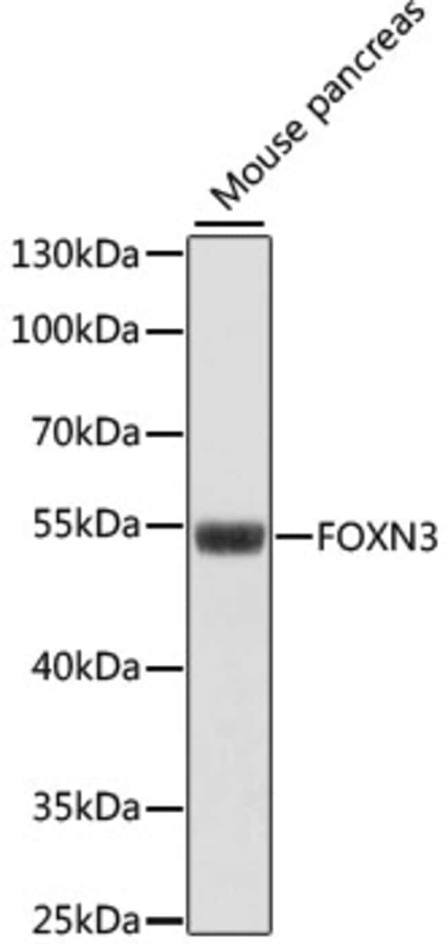 100UL FOXN3 ANTIBODY 100 ul