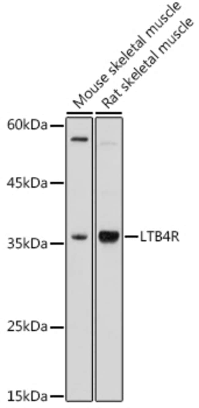 100UL LTB4R ANTIBODY 100 ul