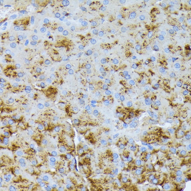 100UL CTRB1 ANTIBODY 100 ul