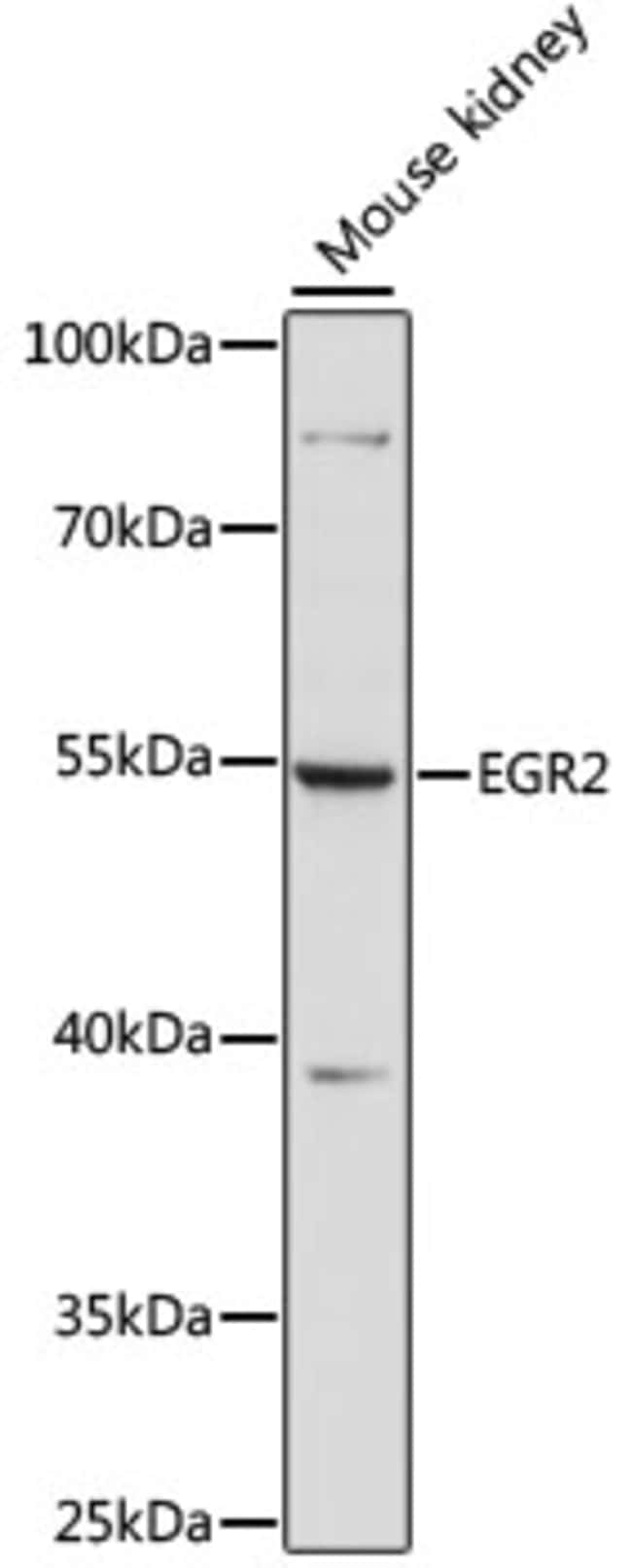 100UL EGR2 ANTIBODY 100 ul