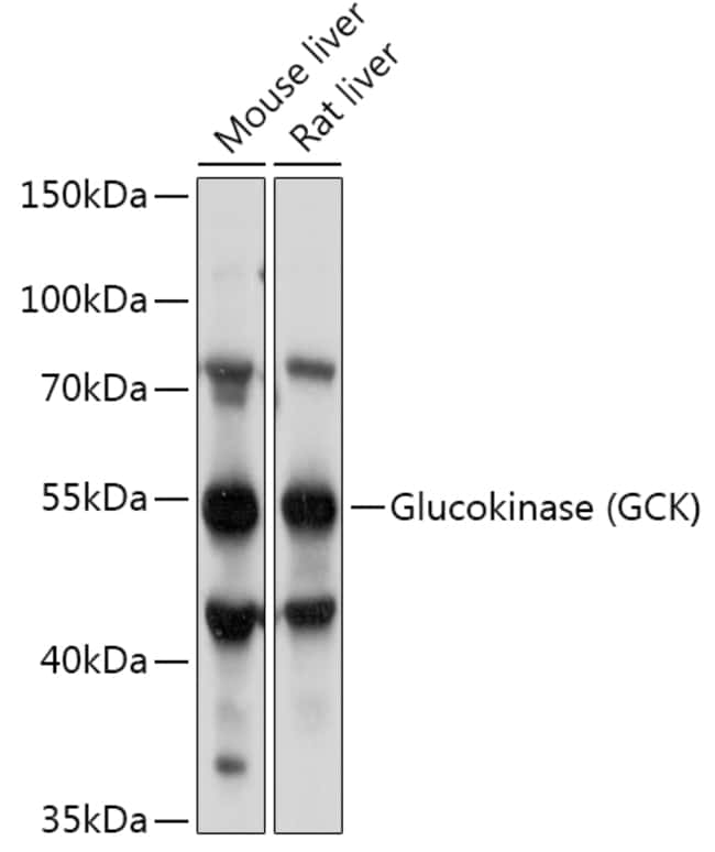 100UL GCK ANTIBODY 100 ul