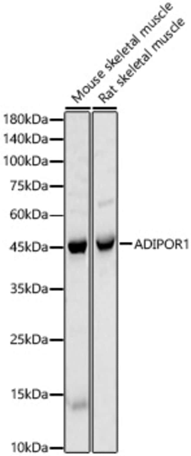 100UL ADIPONECTIN RECEPTOR 1 ANTIBOD 100