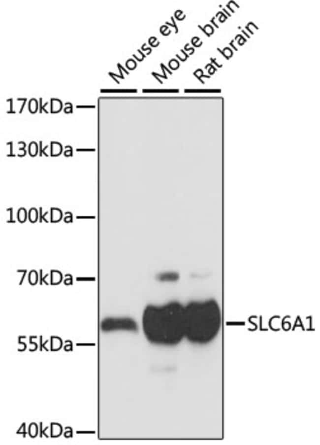 100UL GAT-1 ANTIBODY 100 ul