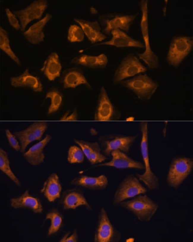 100UL EIF5B ANTIBODY 100 ul