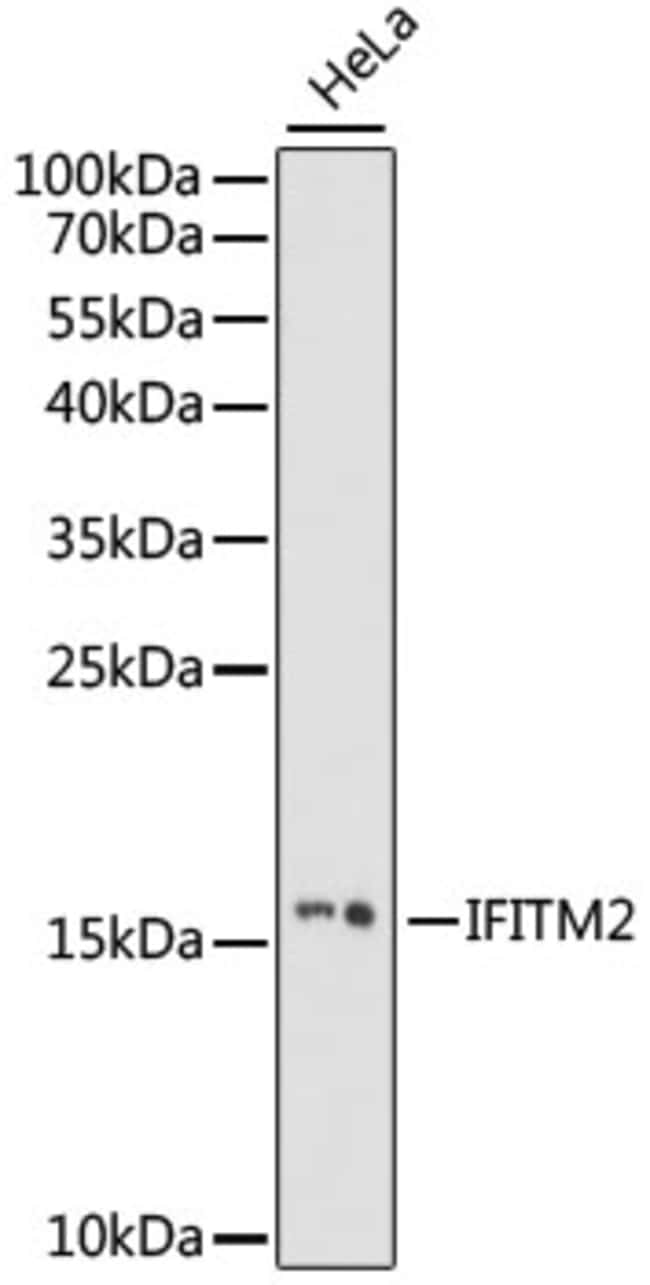 100UL IFITM2 ANTIBODY 100 ul