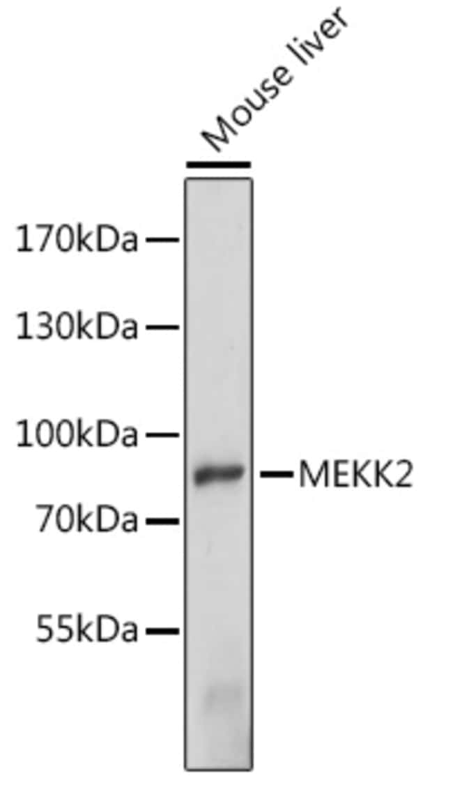 100UL MEKK2 ANTIBODY 100 ul
