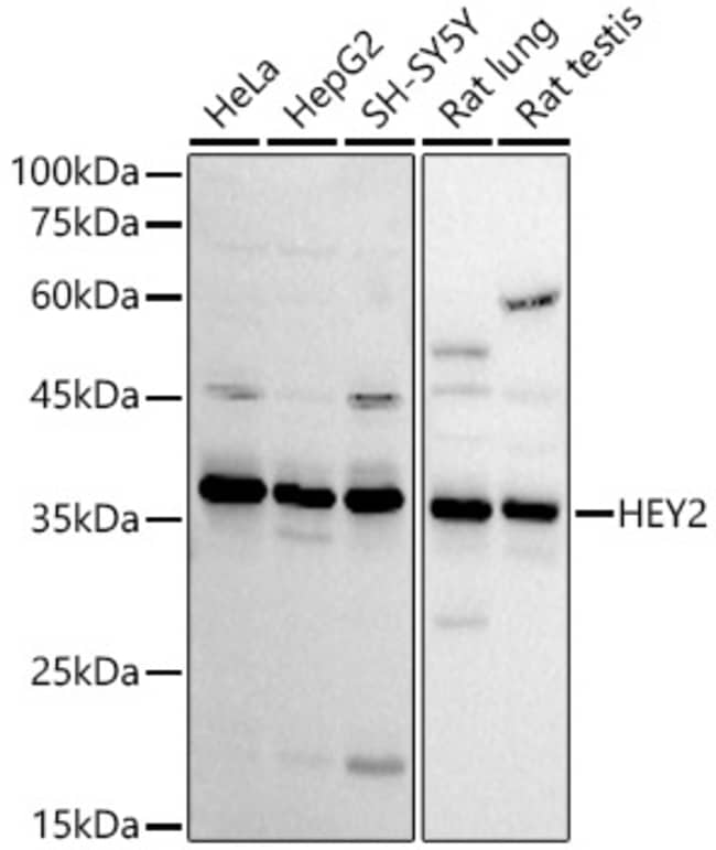 100UL HEY2 ANTIBODY 100 ul