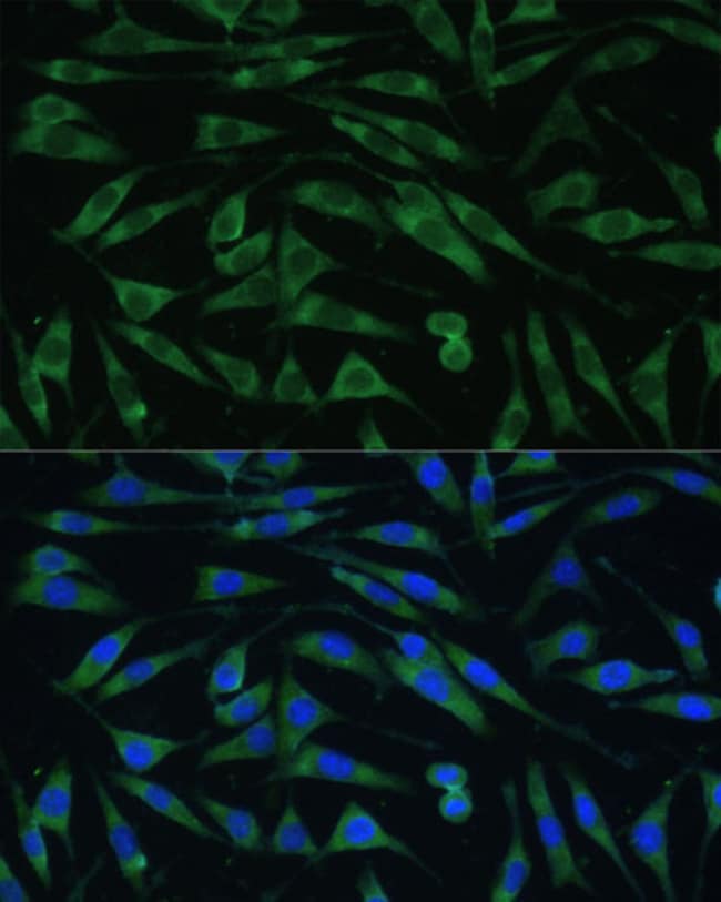 100UL DYNAMIN 3 ANTIBODY 100 ul