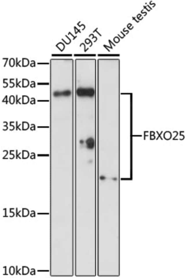 100UL FBXO25 ANTIBODY 100 ul