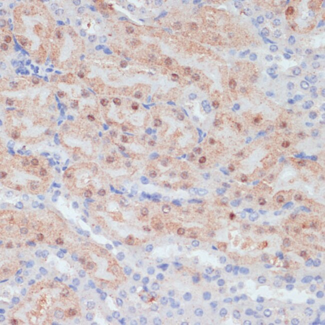 100UL CLAUDIN 17 ANTIBODY 100 ul